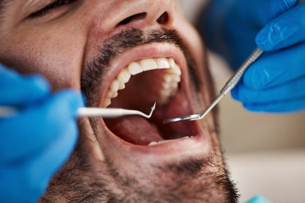 Best Emergency Dental Care for Broken or Chipped Teeth in Dumfries, VA