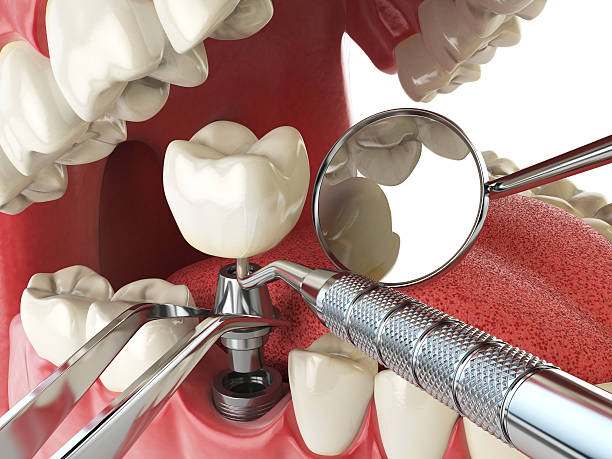 Best Emergency Gum Treatment in Dumfries, VA